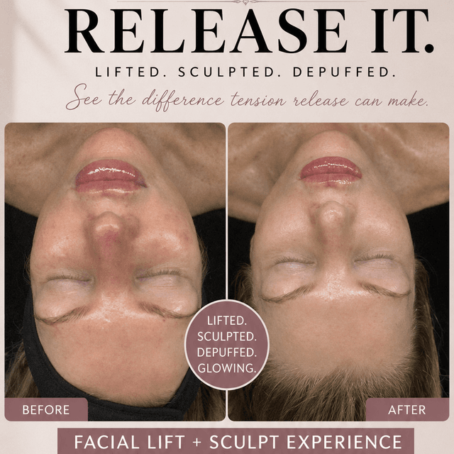 Facial Lift & Sculpt level 1 at Vibrant Esthetics Inc. in Mount Sinai, NY